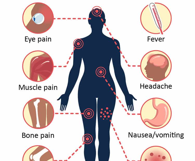 Dengue Viral